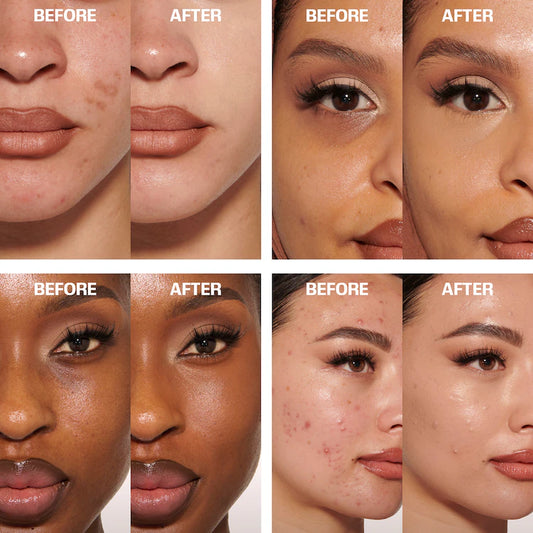 Huda Beauty: Luminous Matte Liquid Concealer - Correttore antiocchiaie liquido